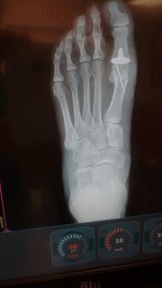 Name:  G8HD5JYm.jpg
Views: 26
Size:  7.4 KB